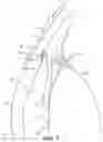 Fig. 02 - Intraocular implants and methods and kits therefor