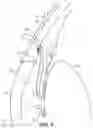 Fig. 03 - Intraocular implants and methods and kits therefor