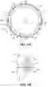 Fig. 05 - Intraocular implants and methods and kits therefor