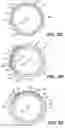 Fig. 06 - Intraocular implants and methods and kits therefor