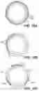 Fig. 11 - Intraocular implants and methods and kits therefor