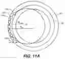 Fig. 12 - Intraocular implants and methods and kits therefor