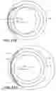 Fig. 13 - Intraocular implants and methods and kits therefor
