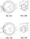 Fig. 15 - Intraocular implants and methods and kits therefor