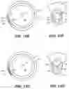 Fig. 16 - Intraocular implants and methods and kits therefor