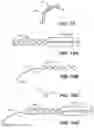 Fig. 17 - Intraocular implants and methods and kits therefor