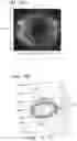 Fig. 25 - Optical surface identification for laser eye surgery