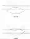 Fig. 28 - Optical surface identification for laser eye surgery