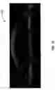 Fig. 29 - Optical surface identification for laser eye surgery