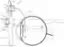 Fig. 01 - INTRAOCULAR AND EXTRAOCULAR DEVICES