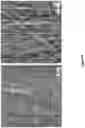 Fig. 05 - Negative Pressure Enhanced Cellular Infiltration