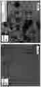 Fig. 07 - Negative Pressure Enhanced Cellular Infiltration