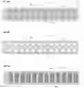 Fig. 09 - Skin closure systems and devices of improved flexibility and stretchability for bendable joints