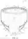 Fig. 12 - Absorbent article with selectively positioned waist containment member having an improved waist seal