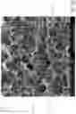 Fig. 19 - Absorbent article with an exudate management layer