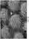 Fig. 09 - Absorbent article with a fluid entangled body facing material including a plurality of projections