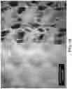Fig. 32 - Absorbent article with a fluid entangled body facing material including a plurality of projections