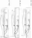 Fig. 16 - Skin injury resistant occupant support structures and methods for resisting skin injuries