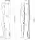 Fig. 25 - Skin injury resistant occupant support structures and methods for resisting skin injuries
