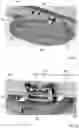 Fig. 38 - Methods and apparatus for body weight support system