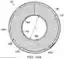 Fig. 11 - Soft-tissue treatment with negative pressure