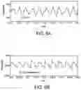 Fig. 09 - Defibrillator display including CPR depth information