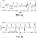 Fig. 10 - Defibrillator display including CPR depth information