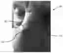 Fig. 01 - Colloidal silver combined with plant extracts for use in treating wounds and other skin conditions