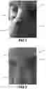 Fig. 02 - Colloidal silver combined with plant extracts for use in treating wounds and other skin conditions