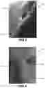 Fig. 03 - Colloidal silver combined with plant extracts for use in treating wounds and other skin conditions