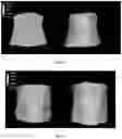 Fig. 10 - Liposomal compositions and methods of use