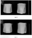 Fig. 11 - Liposomal compositions and methods of use