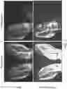 Fig. 04 - METHODS AND MATERIALS FOR REDUCING SCAR FORMATION DURING WOUND HEALING