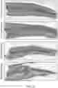 Fig. 10 - METHODS AND MATERIALS FOR REDUCING SCAR FORMATION DURING WOUND HEALING