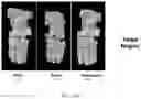 Fig. 33 - Nuclear transport modulators and uses thereof