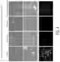 Fig. 05 - Methods of treating inflammatory bowel disease with AMD3100 and Tacrolimus