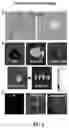 Fig. 07 - Methods of treating inflammatory bowel disease with AMD3100 and Tacrolimus