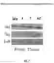 Fig. 08 - Methods of treating inflammatory bowel disease with AMD3100 and Tacrolimus