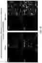 Fig. 11 - Methods of treating inflammatory bowel disease with AMD3100 and Tacrolimus