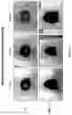 Fig. 19 - Methods of treating inflammatory bowel disease with AMD3100 and Tacrolimus