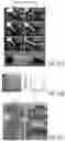 Fig. 23 - Methods of treating inflammatory bowel disease with AMD3100 and Tacrolimus