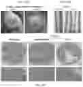 Fig. 26 - Methods of treating inflammatory bowel disease with AMD3100 and Tacrolimus