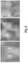 Fig. 03 - Process for the preparation of a pharmaceutical composition containing pirfenidone in sustained-release tablet form and its application in the regression of human chronic renal failure, breast capsular contracture and hepatic fibrosis