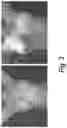 Fig. 04 - Process for the preparation of a pharmaceutical composition containing pirfenidone in sustained-release tablet form and its application in the regression of human chronic renal failure, breast capsular contracture and hepatic fibrosis