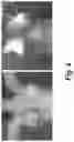 Fig. 05 - Process for the preparation of a pharmaceutical composition containing pirfenidone in sustained-release tablet form and its application in the regression of human chronic renal failure, breast capsular contracture and hepatic fibrosis