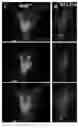 Fig. 34 - Methods of inhibiting viruses using compositions targeting TSG101-ubiquitin interaction