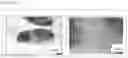 Fig. 04 - Drug effective for lymphogenous drug administrating method