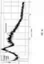 Fig. 03 - Salts and solid form of a BTK inhibitor