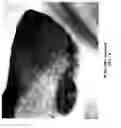 Fig. 16 - Salts and solid form of a BTK inhibitor