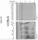 Fig. 16 - METHODS OF TREATING PARKINSON'S DISEASE USING AMINOSTEROL COMPOSITIONS